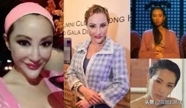 微整形需要多久,微整形后多久恢复正常