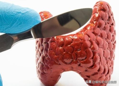 怕热心慌是什么情况,怕热出汗心慌怎么回事