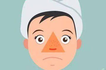 鼻子上的脓包能挤吗怎么处理,鼻子内长了个脓包可以刺破吗