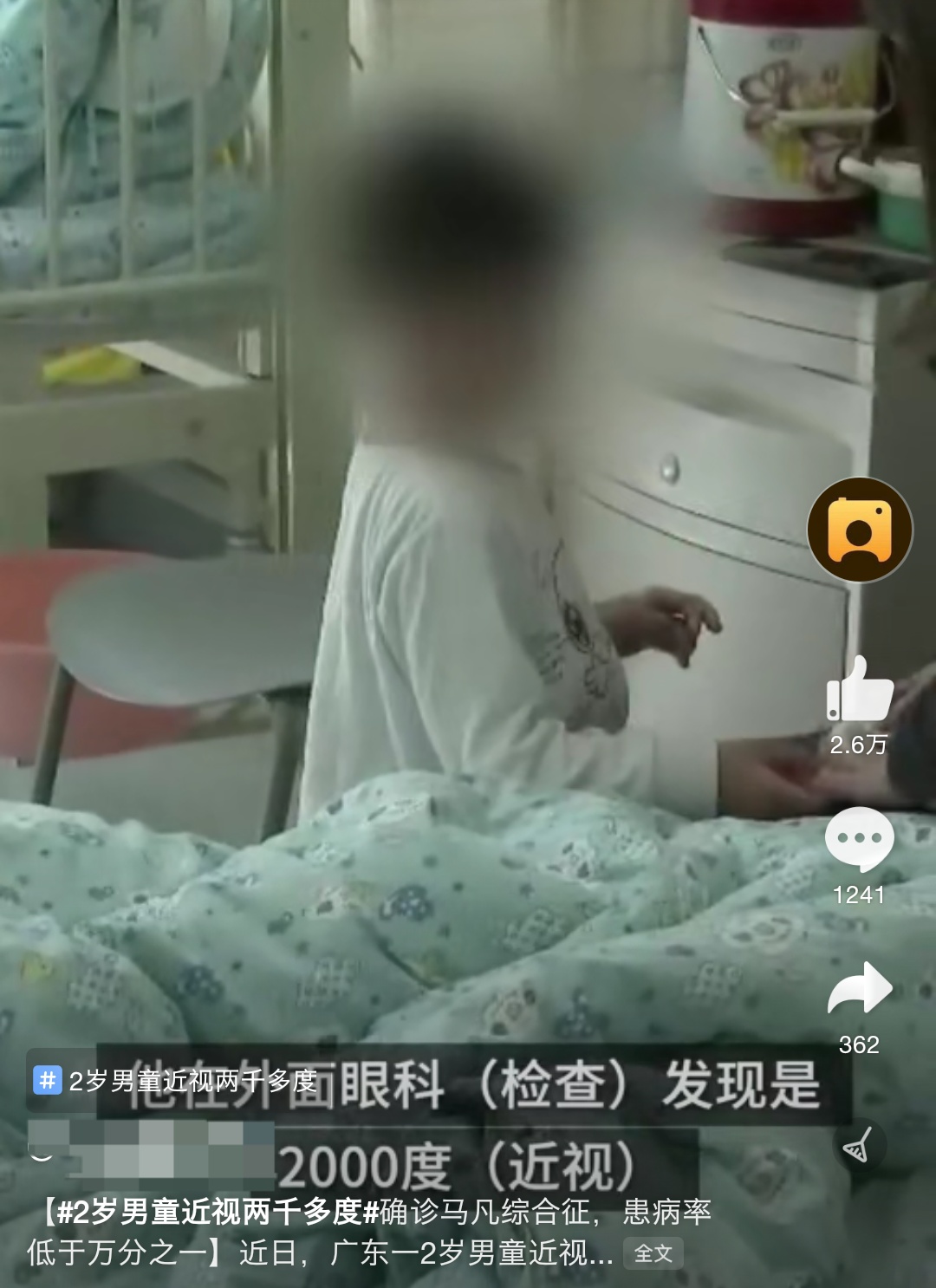 8岁孩子近视250度最佳治疗方案,4岁小朋友先天近视1000度怎么办