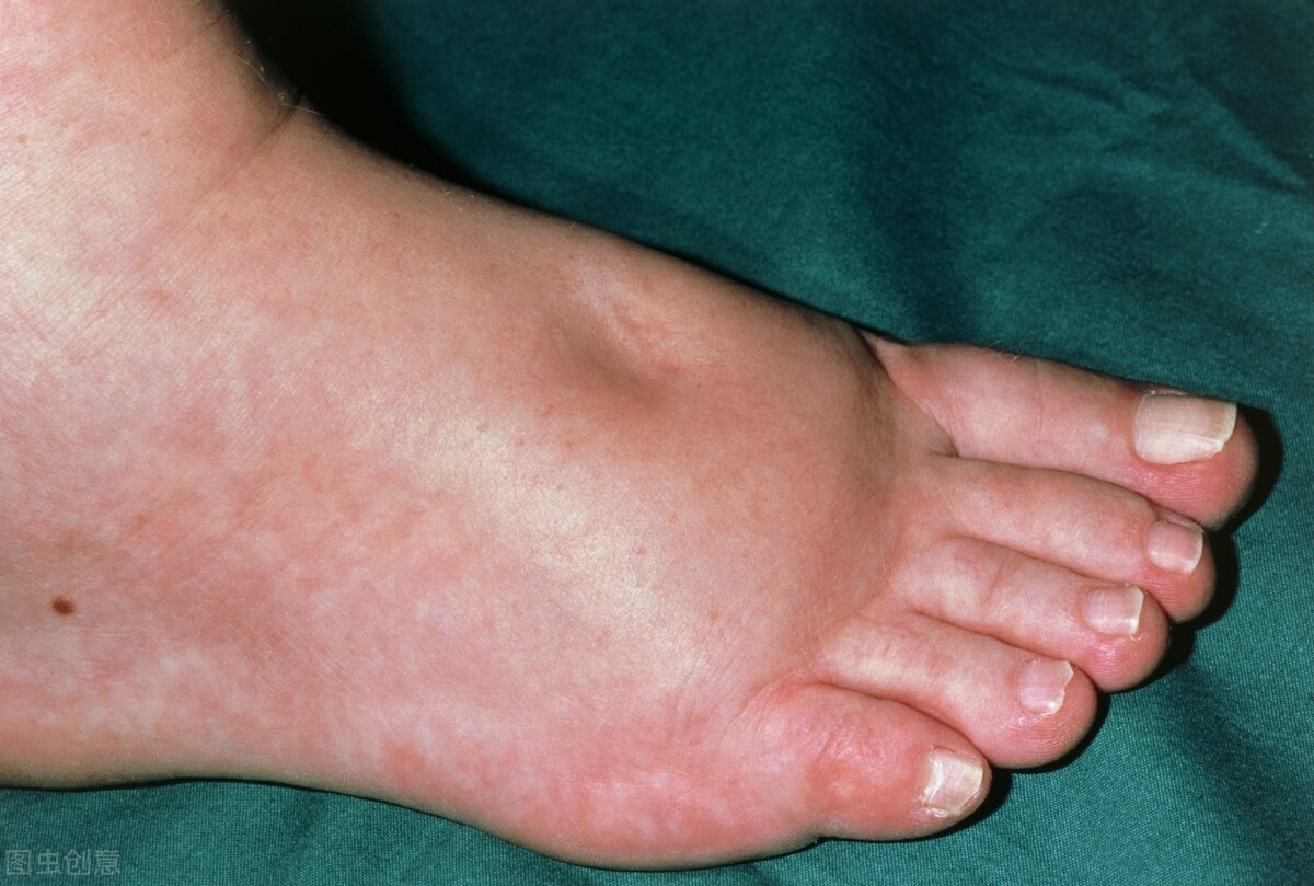 心衰的症状判断心衰的最佳方法,心衰各个级别的症状有哪些