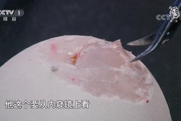 医学缝针练习,医生如何练习缝针