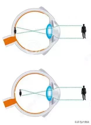 6部门联合发声“近视根本不能治愈!视力有问题哪些专业不能报?