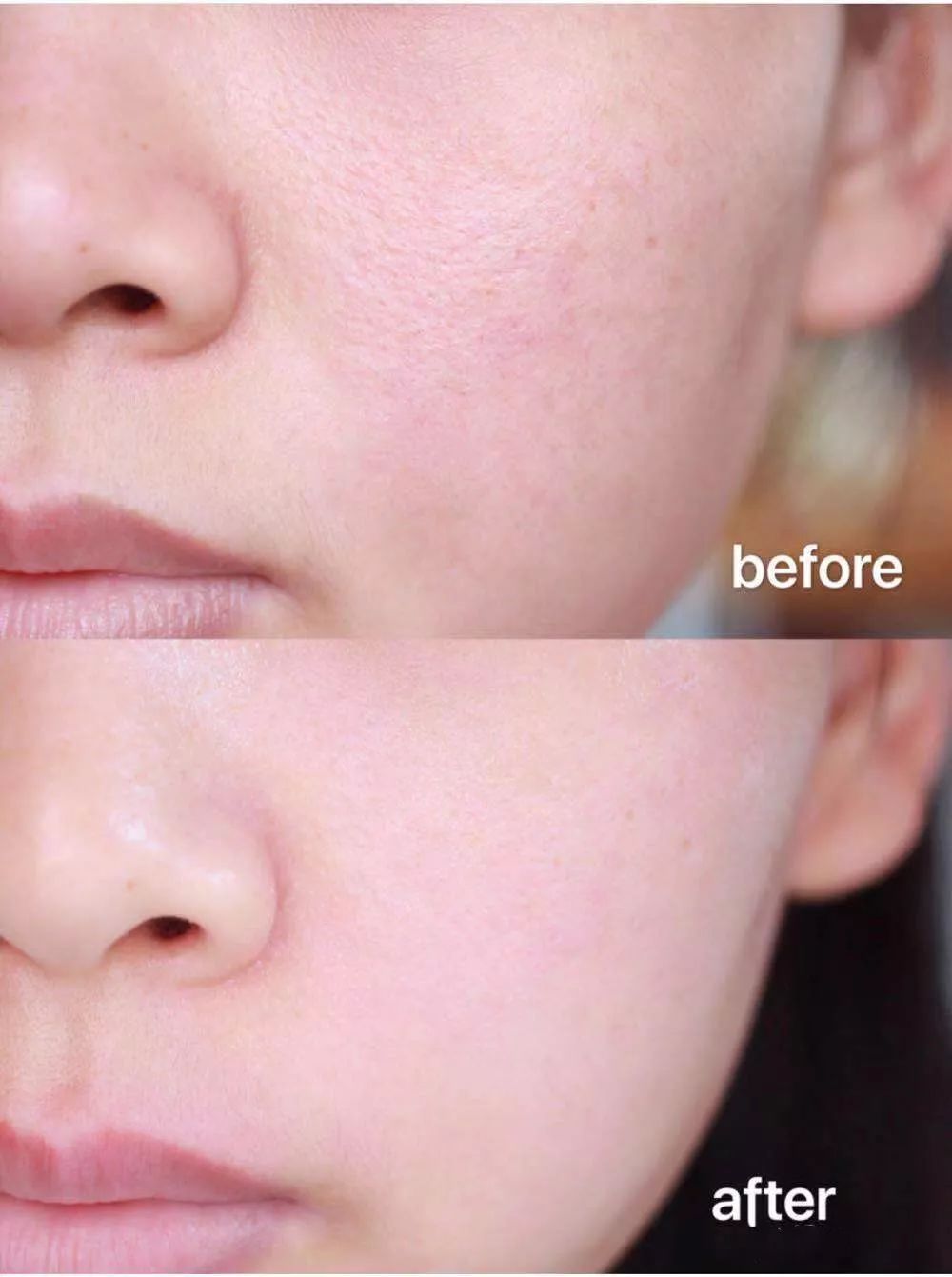 长黑头VS不长黑头差距这么大?精致女孩如何绕过黑头这道坎?