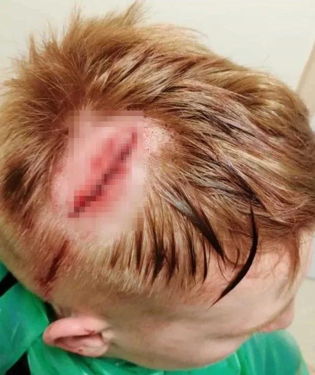 英国17岁男孩暴打警察,16岁足球运动员被打