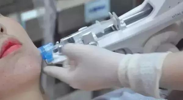 关于水光针，你被忽悠了吗？