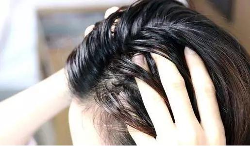 头发上面油下面干怎么办,洗完头怎么防止头发油