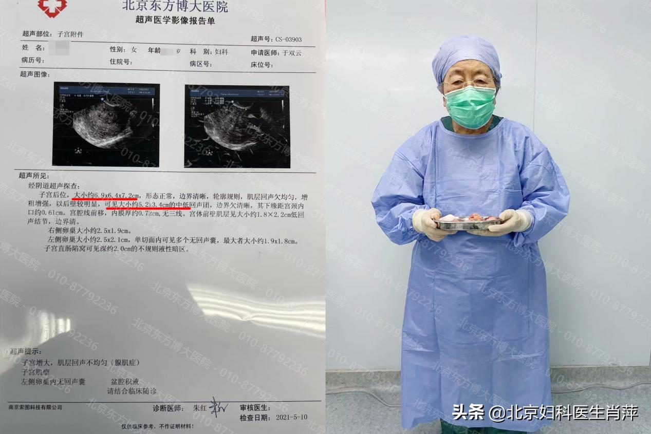 腺肌症手术保宫治疗需要注意什么,腺肌症调理