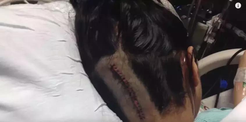 全身瘫痪，经历10次手术后康复，她就这样一步一步实现了医生梦