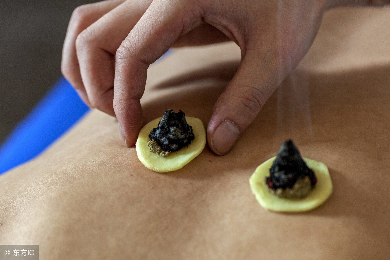 艾灸和针灸疏通经络哪个效果好,痛经是艾灸效果好还是针灸效果好