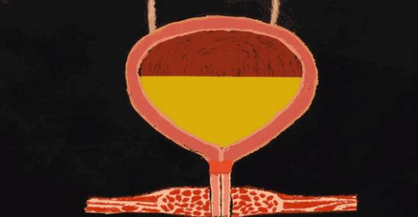 只要膀胱不炸裂，我憋着尿能把这套题做满分