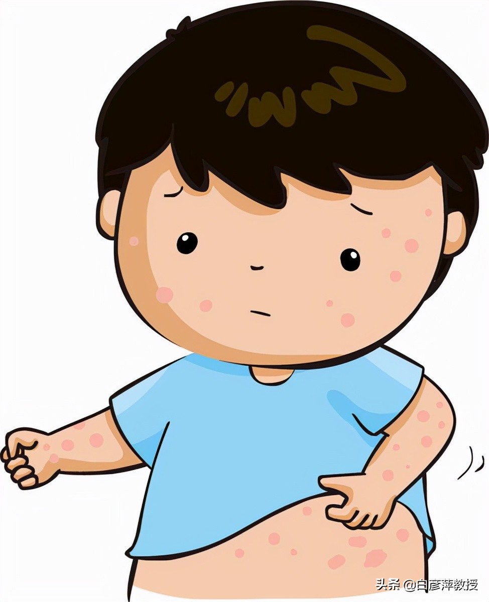 湿疹和荨麻疹症状有什么区别,红疹和湿疹的区别