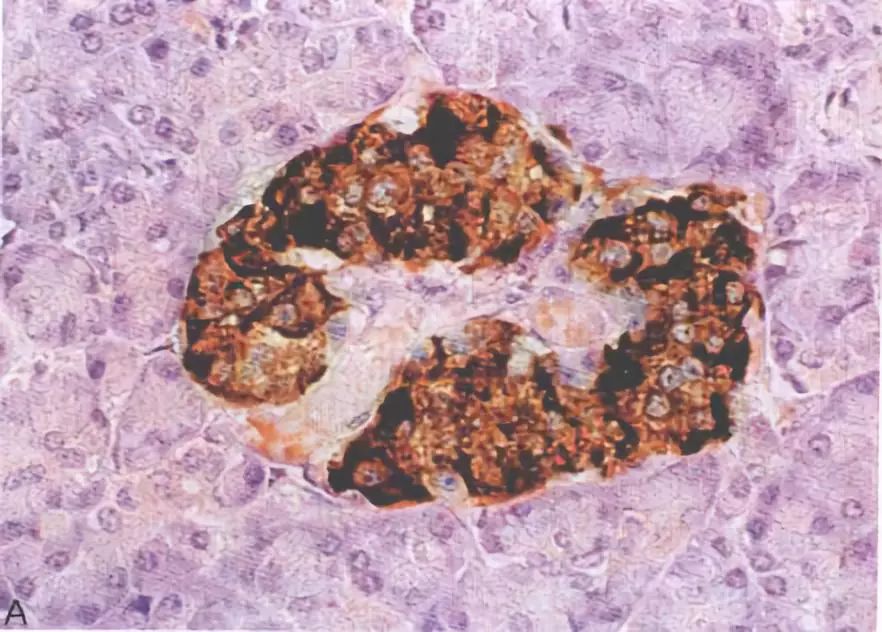 一天喝八杯奶茶会死吗,一天喝杯奶茶会发胖吗