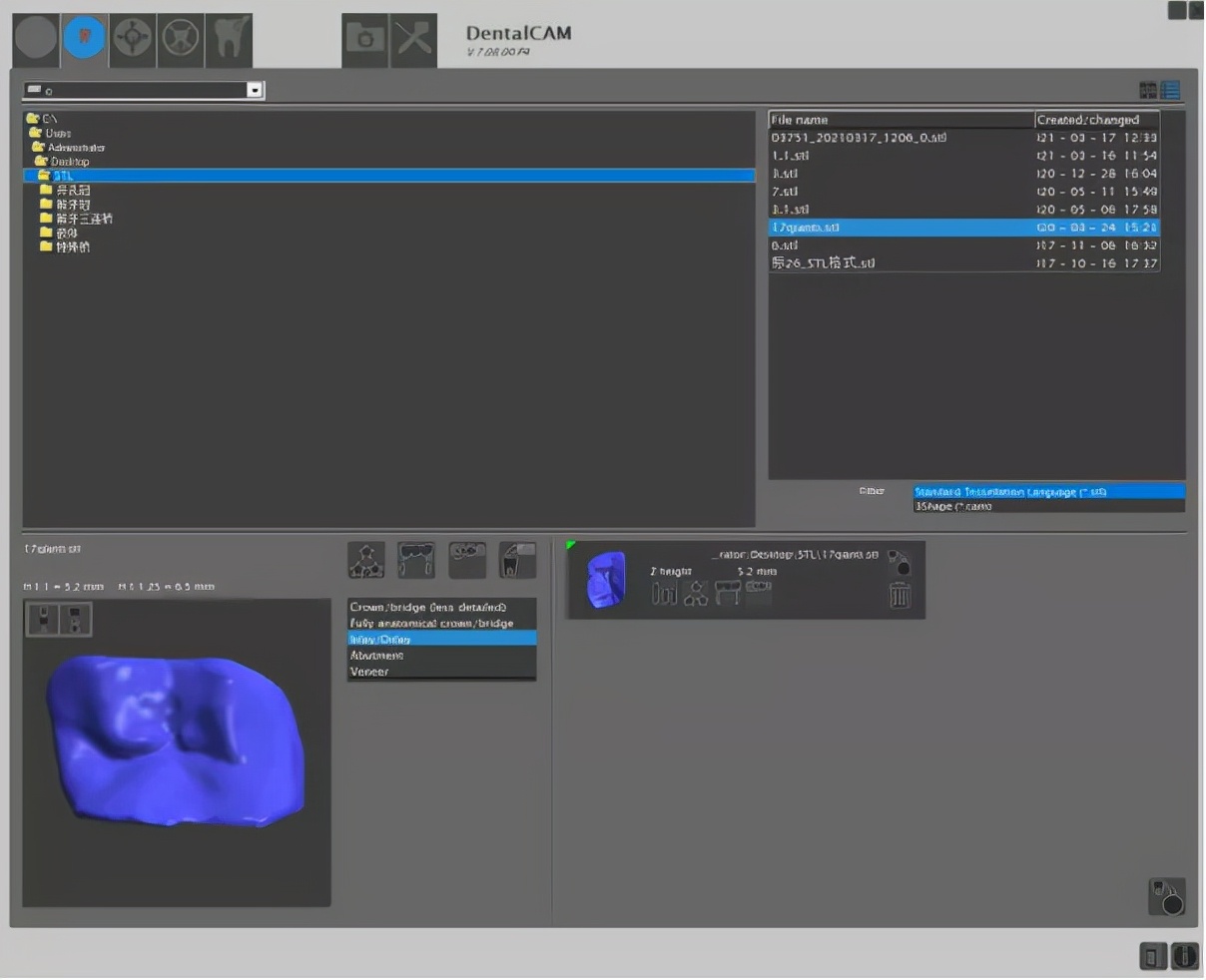 椅子修复工艺视频,椅旁修复技术安全性