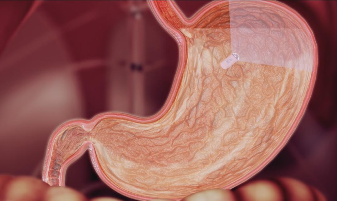澶у湥纾佹帶鑳跺泭鑳冮暅鎿嶄綔瑙嗛,澶у湥鑳跺泭鑳冮暅瀹樼綉