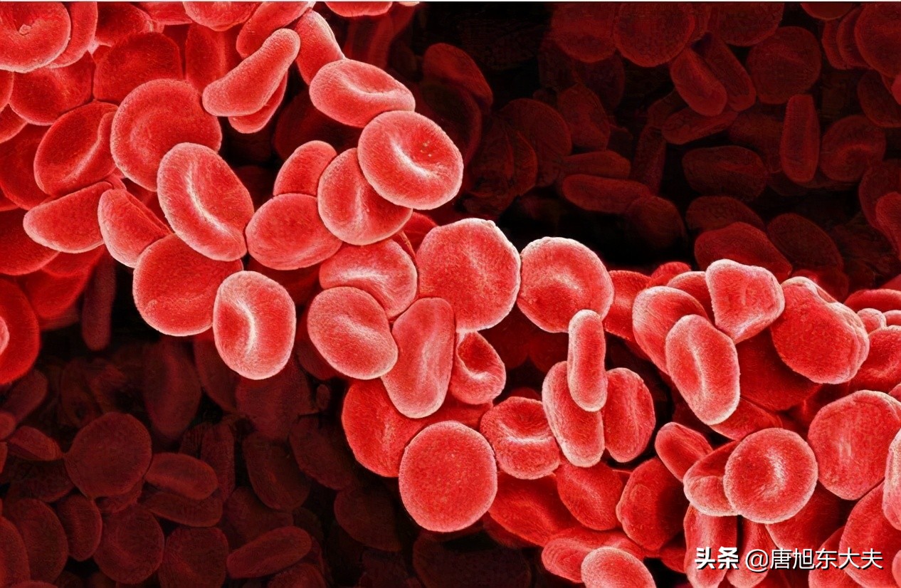 严重贫血血小板少是什么意思,血小板减少性紫癜引起月经过多