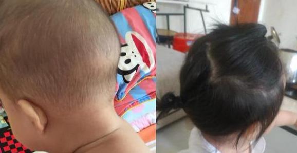 如何改变胎毛生长方向,怎么改变胎毛生长方向