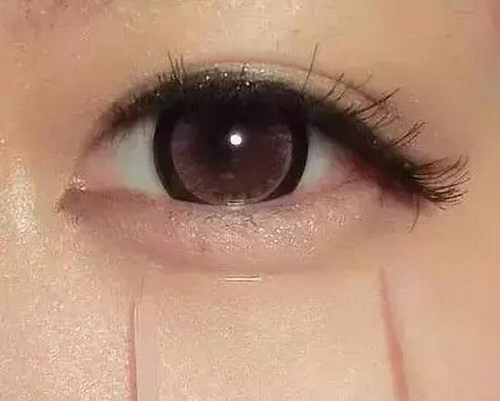 脸部卧蚕什么样,卧蚕都有哪些类型