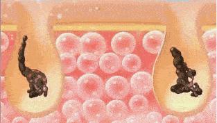 洗澡时搓出来的泥是怎么回事,为什么洗澡搓泥是白泥