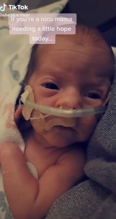 妈妈记录三胞胎一天奶量,三胞胎妈妈喂小宝宝