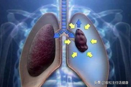 不想去医院第二弹！胸部不适的自我诊察