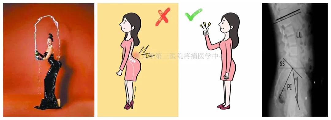 骨科医生久坐缓解方法,骨科大夫严玉贵说久坐危害大