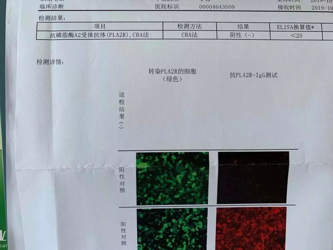 从正常发展到尿毒症要多久,开始肾病到死亡有多长时间