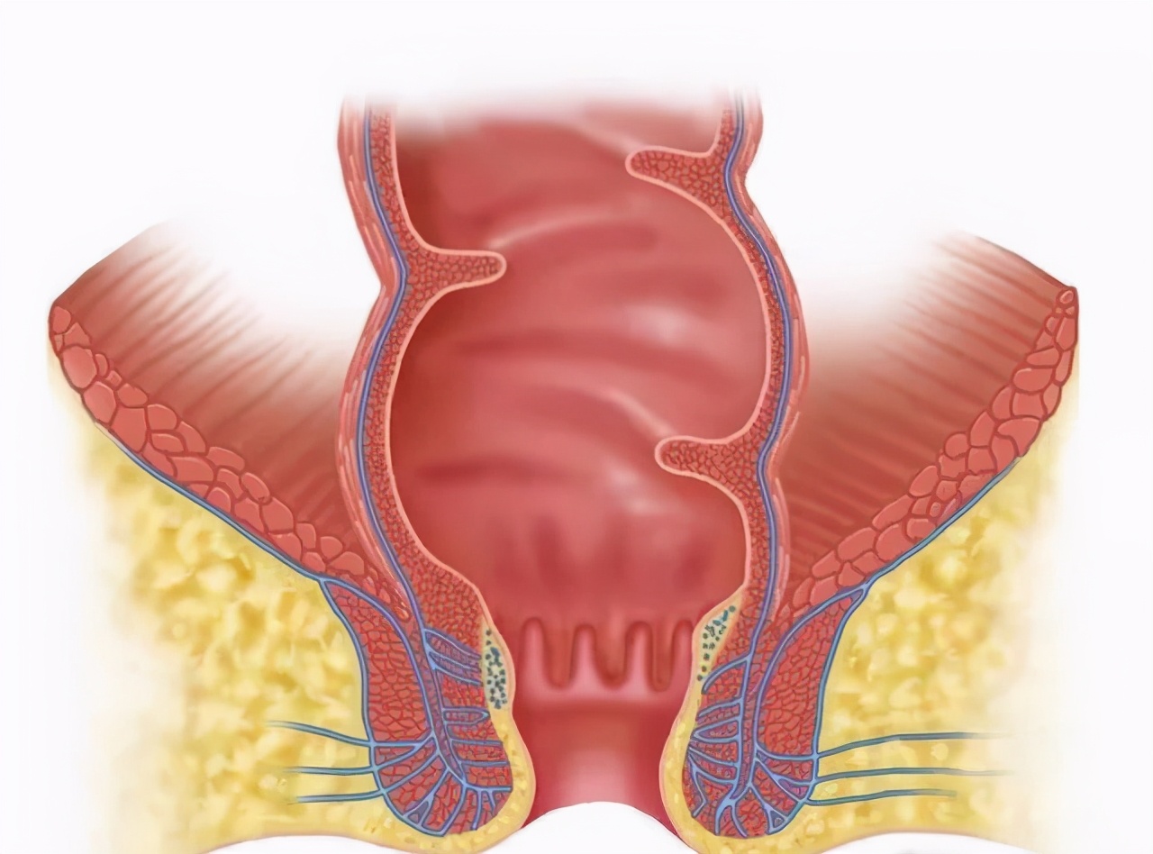 治疗便秘被禁的药是什么,酚酞治便秘能长期服用吗