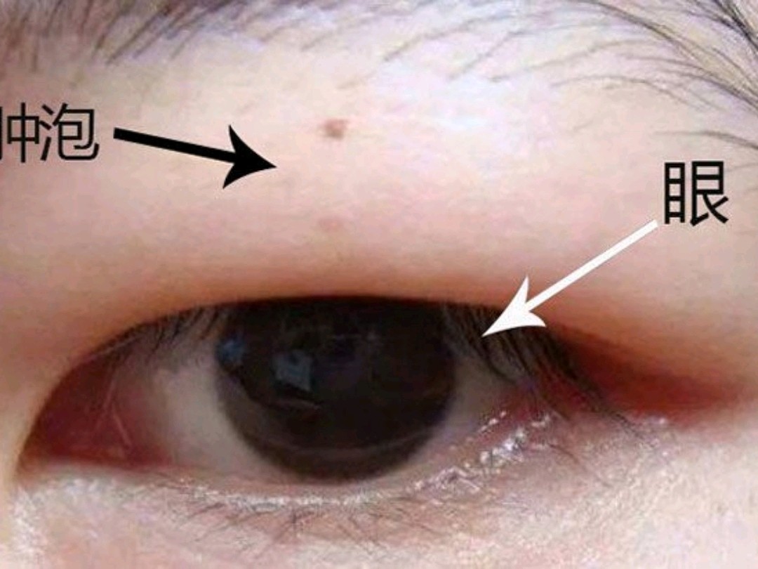 上海九院孙沣擅长做什么手术,上海九院孙沣