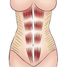 产后腹直肌分离科普视频,产后大肚子腹直肌分离如何恢复