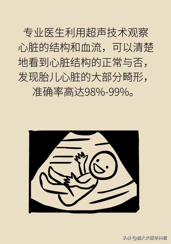 产检查出胎儿有问题,胎儿心脏有问题产检能发现吗