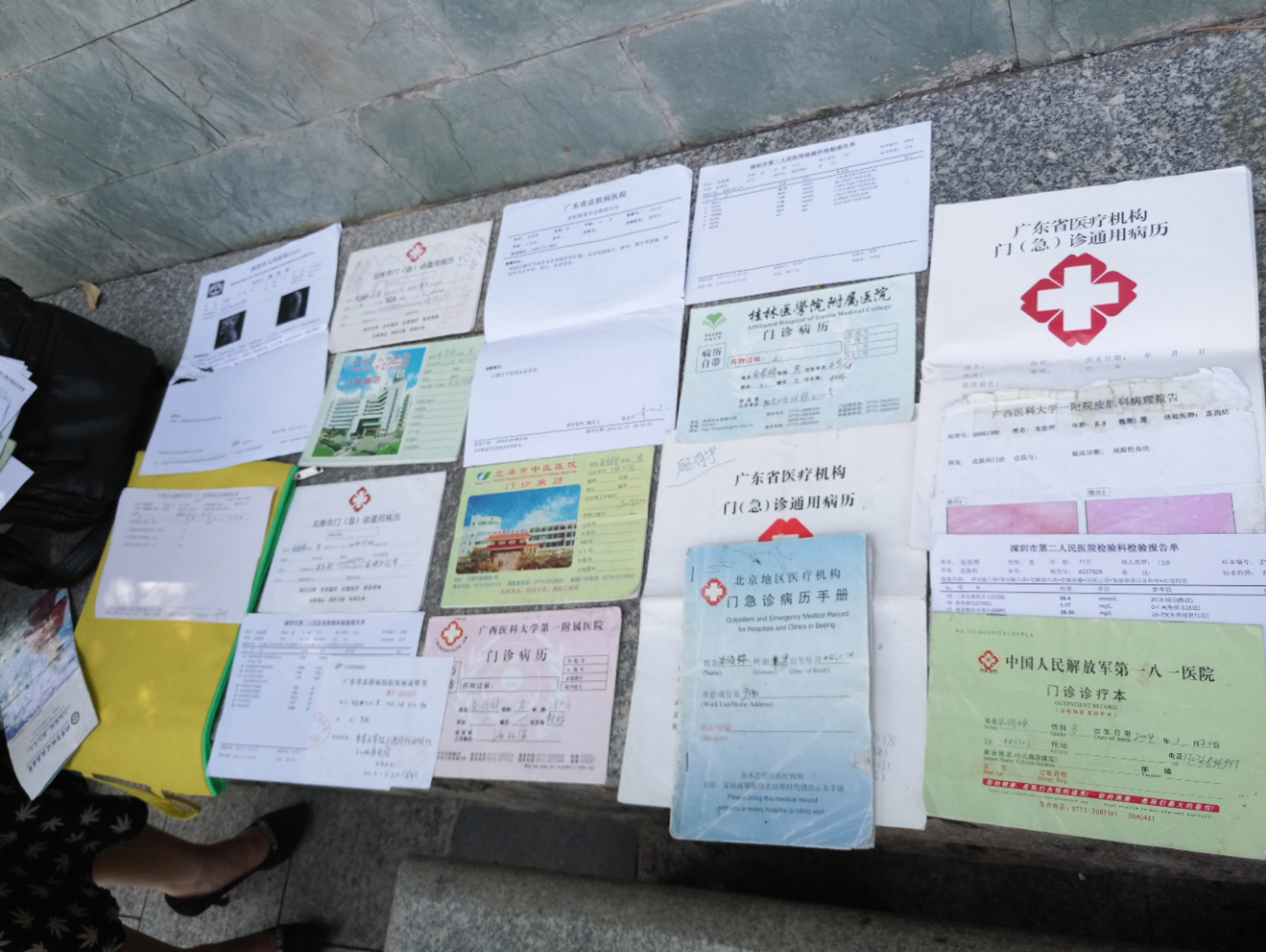 5岁脸部毛周角化症怎么治疗,2岁宝宝皮肤角化