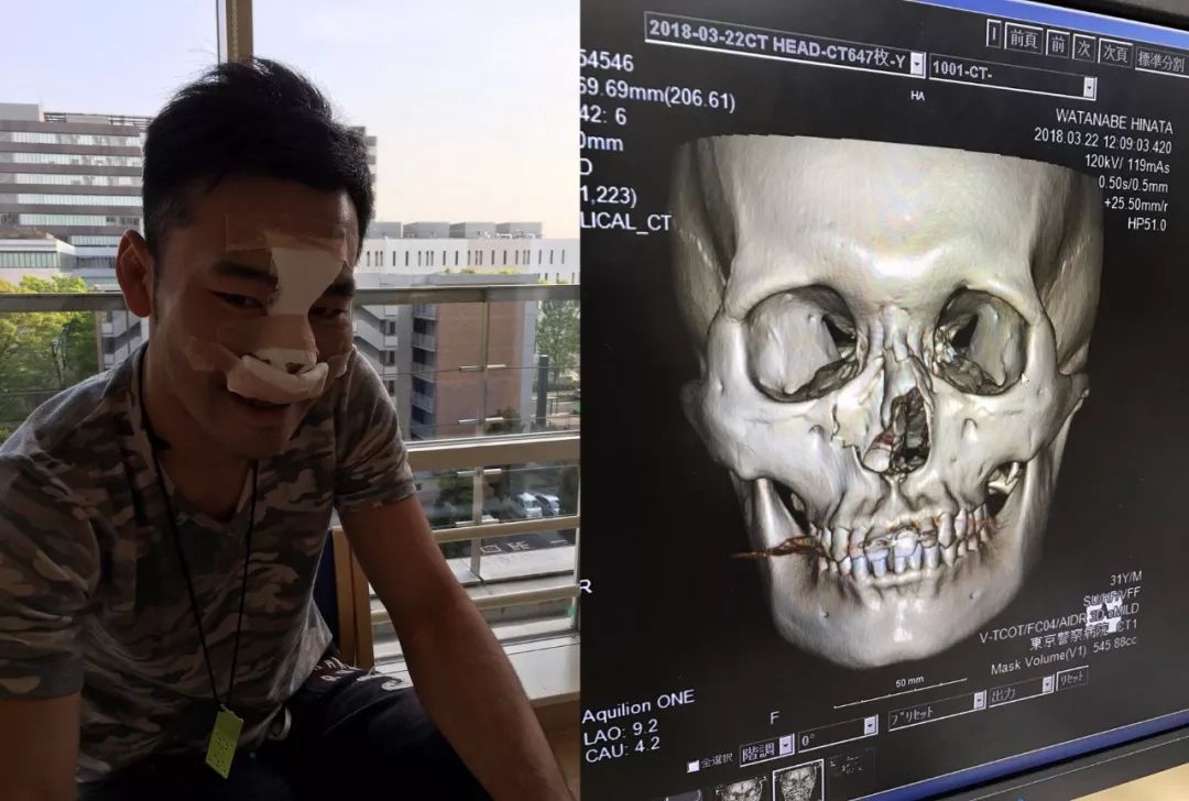 泰拳江通猜最新比赛,泰拳王江通猜个人集锦