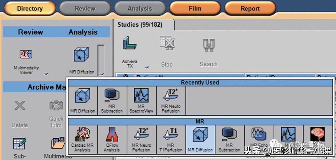 飞利浦磁共振波谱成像扫描技术,飞利浦磁共振纵隔扫描技术