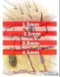 40岁女性适合的身体整形医美项目,40岁的女人整形手术