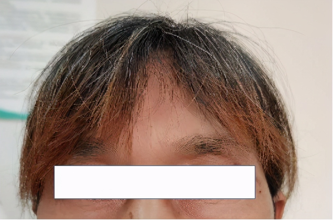 阿胶补哪里的血,吃阿胶红糖补血吗