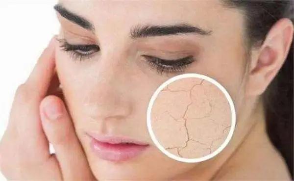 油性皮肤化妆后脸上起皮怎么补救,泽佳祛斑的最佳方法