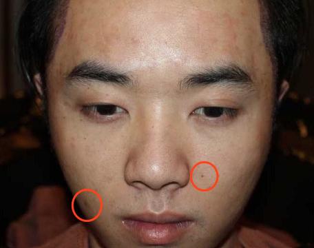 疑似华晨宇女友放锤！曝光其植发整容照，怒斥张碧晨插足当小三