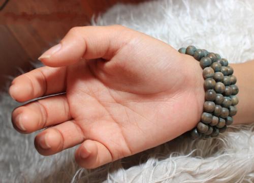 手脱皮是什么原因该怎么办,手脱皮是什么原因造成的怎么治疗