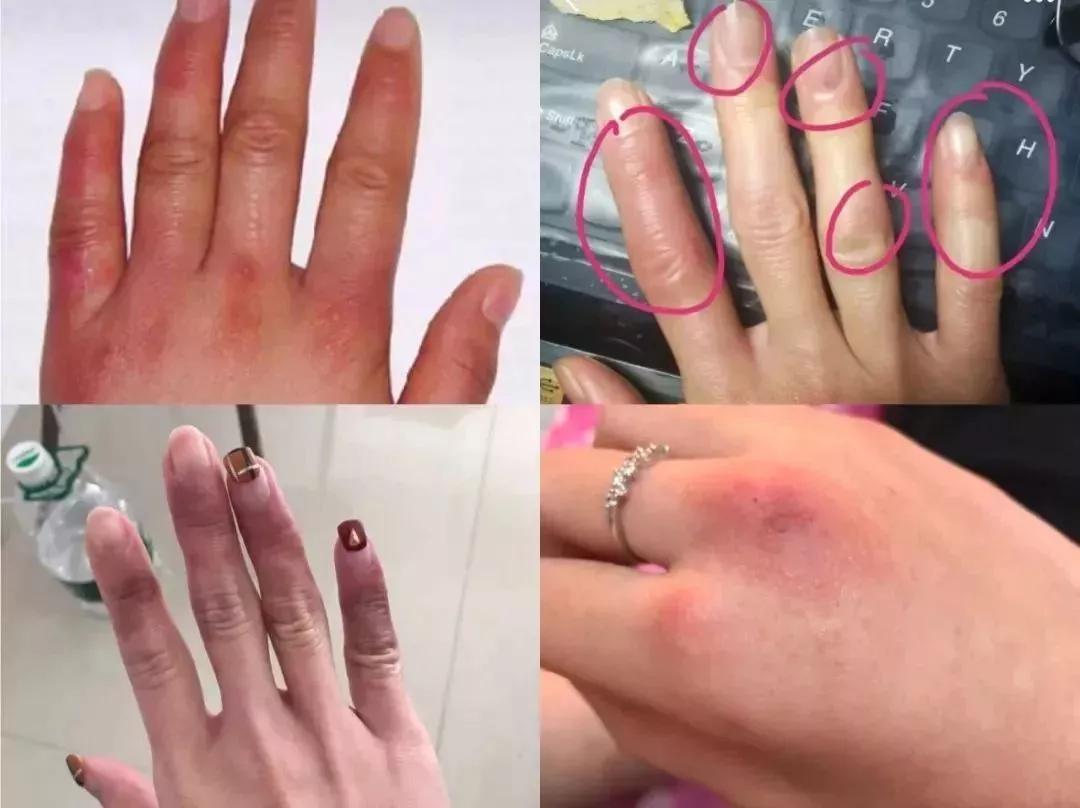 祛除角质细纹的护手霜,干裂护手霜秋冬季