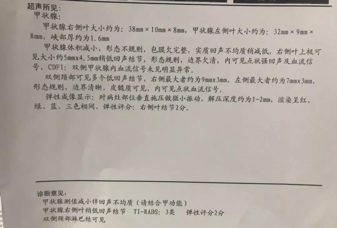 儿子陪父亲治疗甲亢，自己却被查出甲亢，医生一眼看出端倪