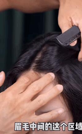 颅顶低如何拯救马尾发型,颅顶高可以拯救高发际线吗