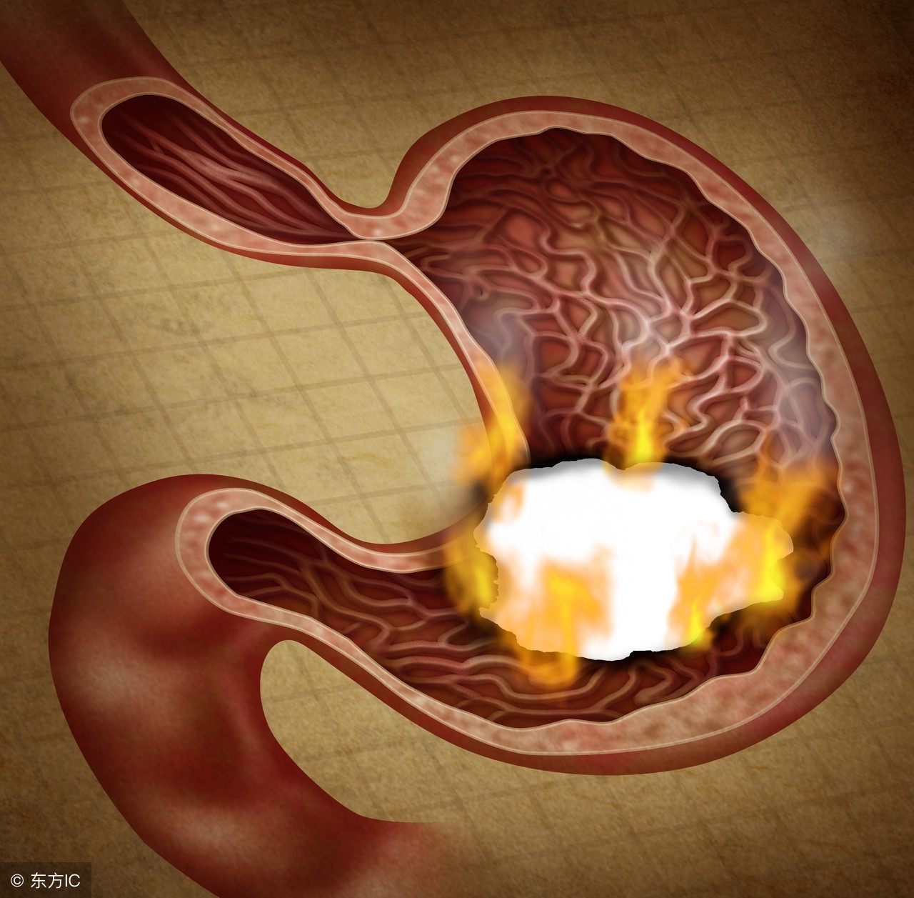 胃火旺喝金银花还是蒲公英麦冬,治胃火的麦冬金银花一次喝多少