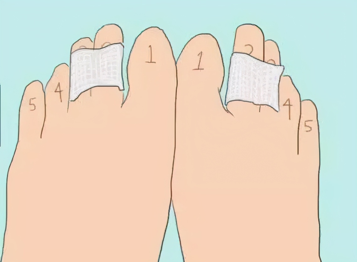 怎么证明没脚气,没有药如何处理脚气