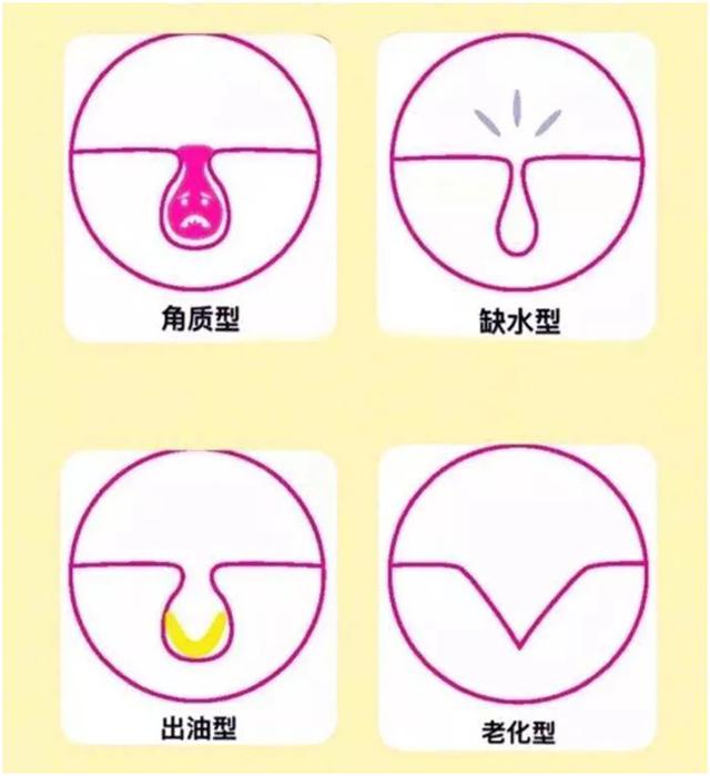 毛孔大皮肤粗糙怎么办,毛孔大皮肤变好