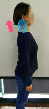 怎么预防脖子有个富贵包,脖子后的富贵包真是夺命包