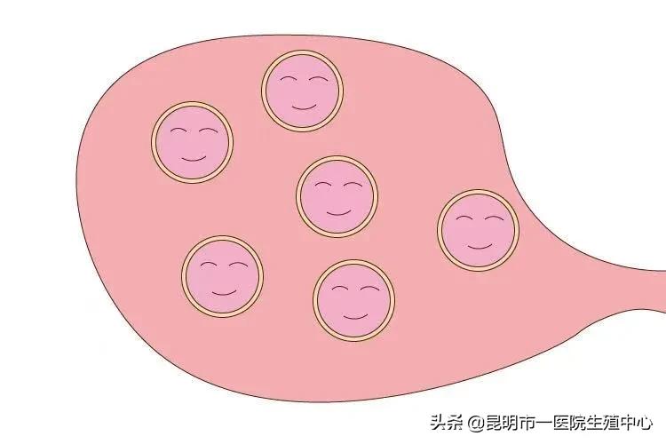 判断女人是否拥有高质量卵子，主要就看这三点