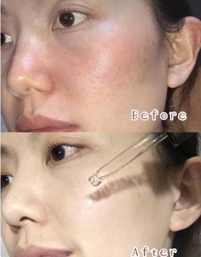 屈臣氏魔法医生精华,屈臣氏李佳琦精华