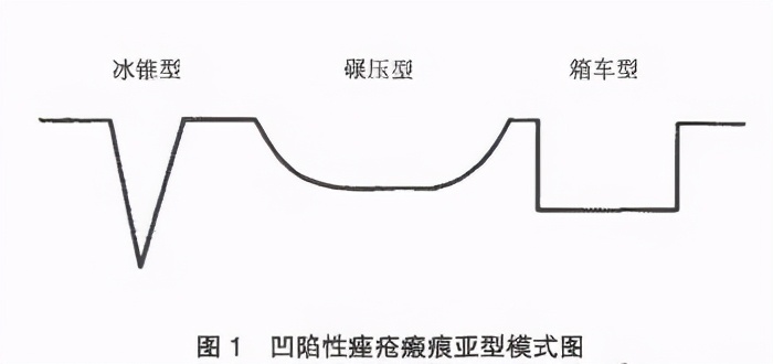 痘痘留下的凸起瘢痕怎么去除,痘痘好了留下肉疙瘩怎么治疗