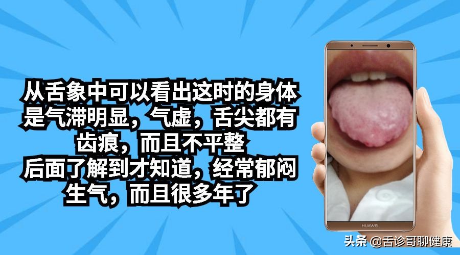 舌诊哥肝郁脾虚,抖音舌诊哥的感悟